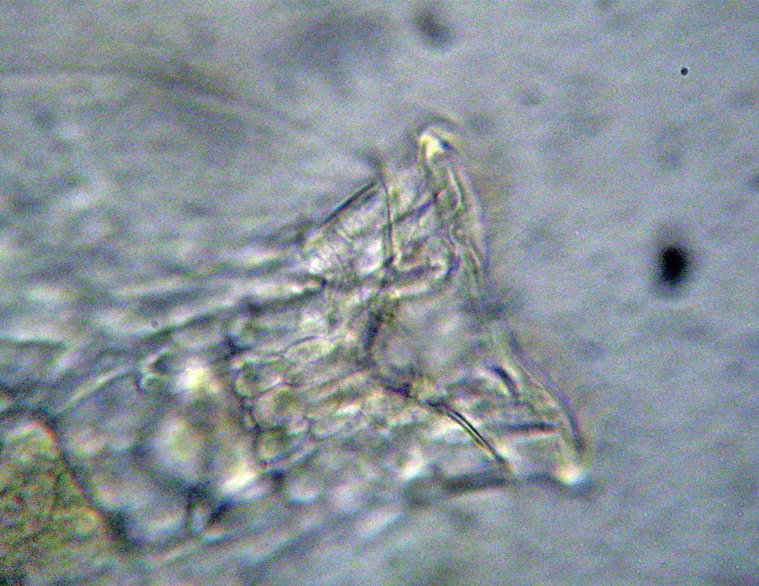 Rotiferi nel fosso: Testudinella patina